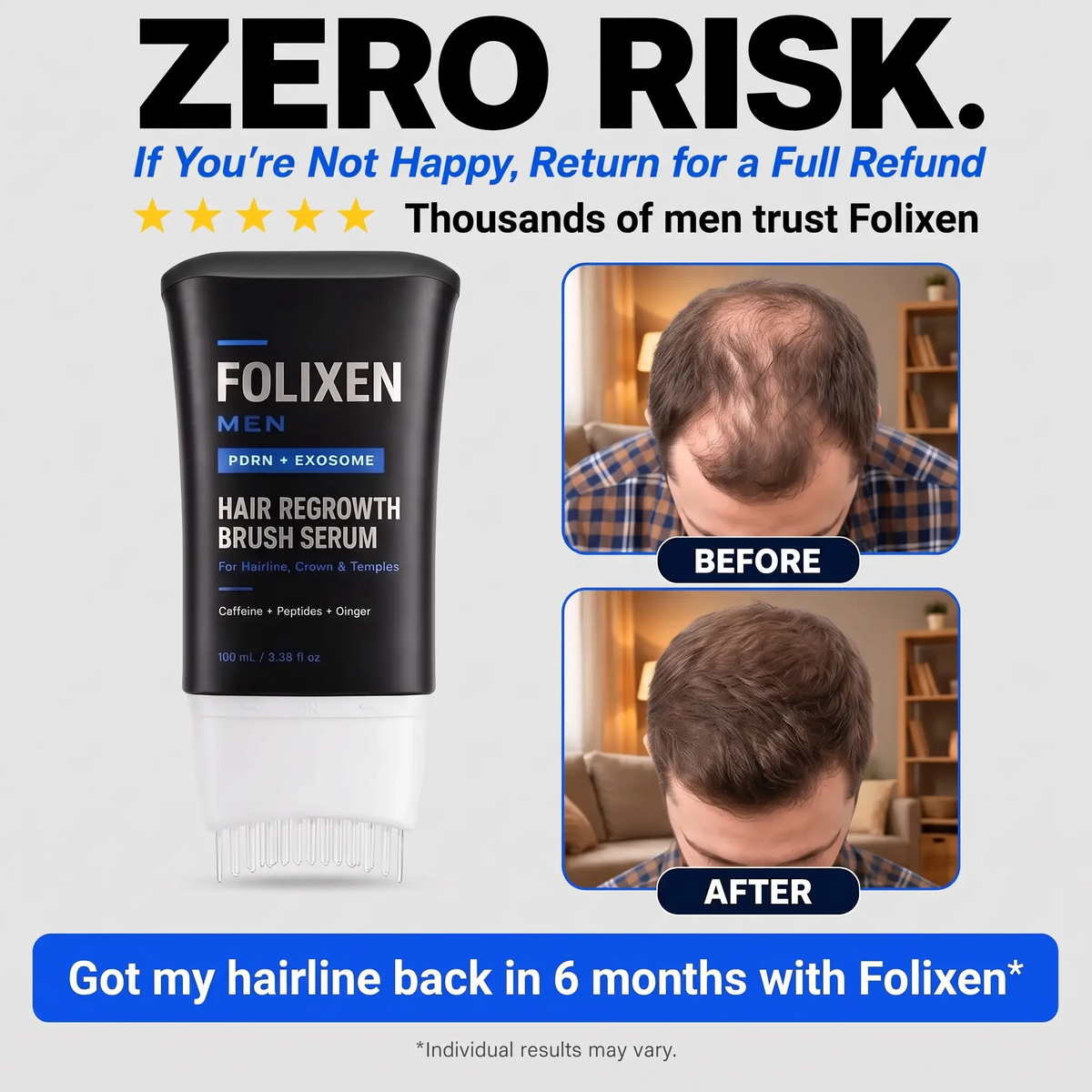 Folixen Hair Density Solution